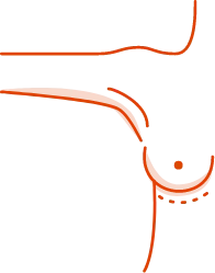 Inframammary fold