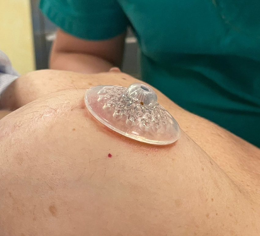 GC Aesthetics® medical illustration